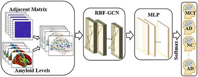 Regional Brain Fusion: Graph Convolutional Network for Alzheimer's Disease Prediction and Analysis